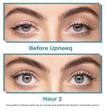 Upneeq Rx - Medical Questionnaire Required. See Instructions Below. - EYEBAR HOUSTON
