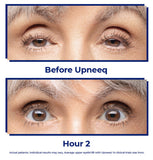 Upneeq Rx - Medical Questionnaire Required. See Instructions Below. - EYEBAR HOUSTON